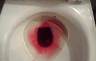 Uroferon main